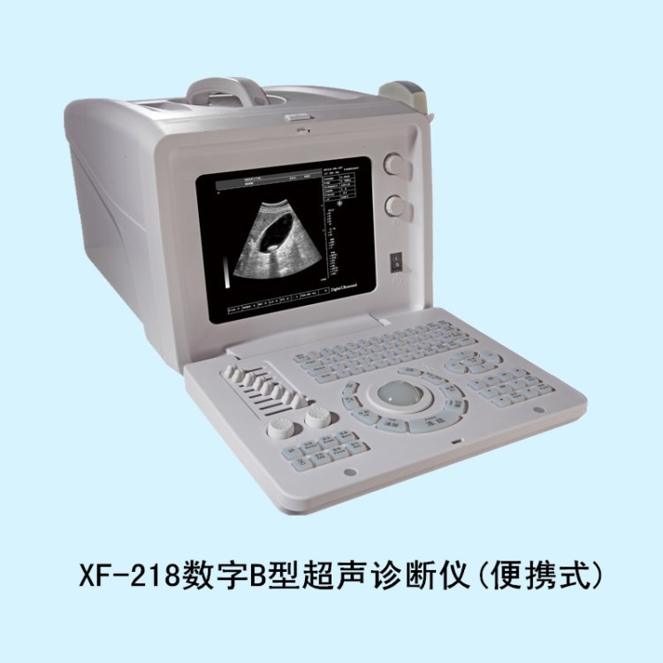 XF218数字B型超声诊断仪便携式 黑白超 B超