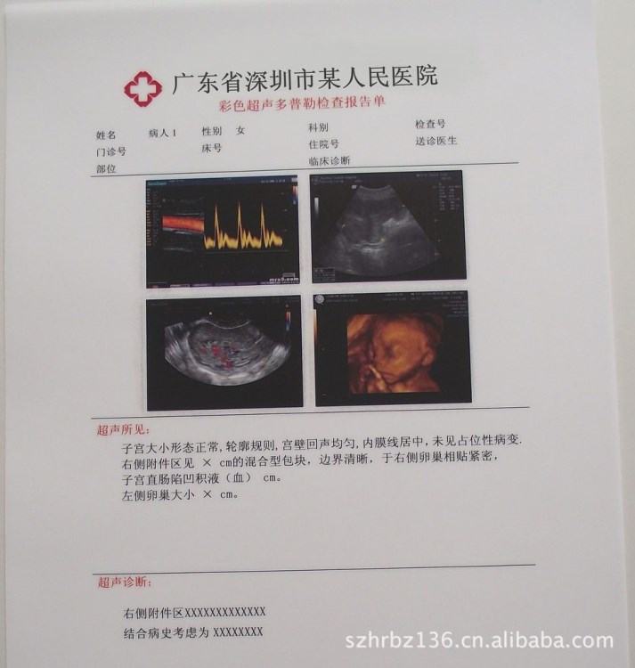 供应激光打印胶片、B超打印胶片