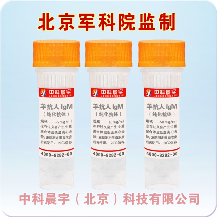 羊抗人IgM（μ链特异）化抗体，167012-50mg/2~3ml